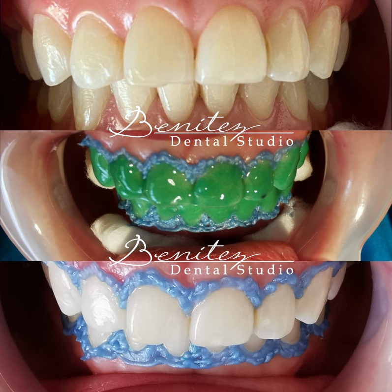 Benítez Dental Studio