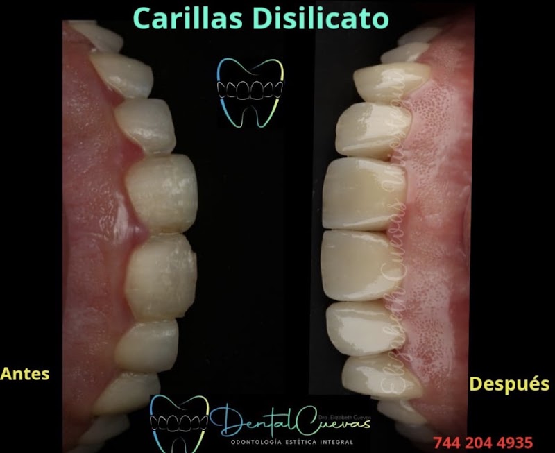Consultorio Dental Cuevas