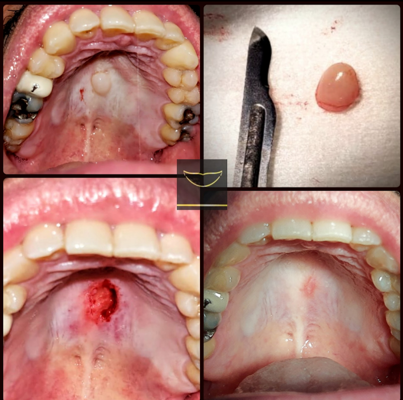Consultorio Dental Acapulco dr Saudi