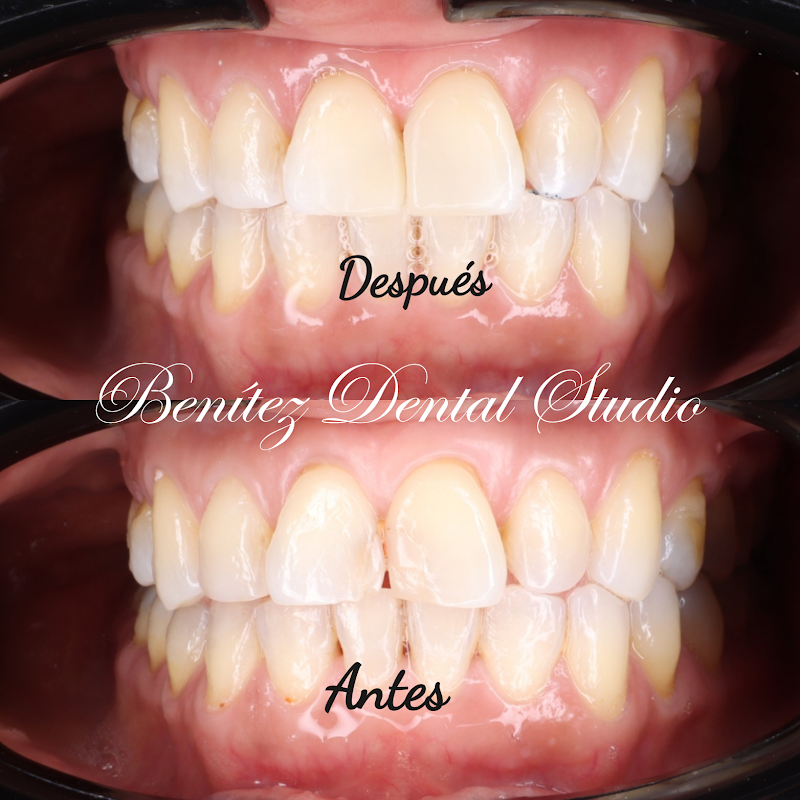 Benítez Dental Studio